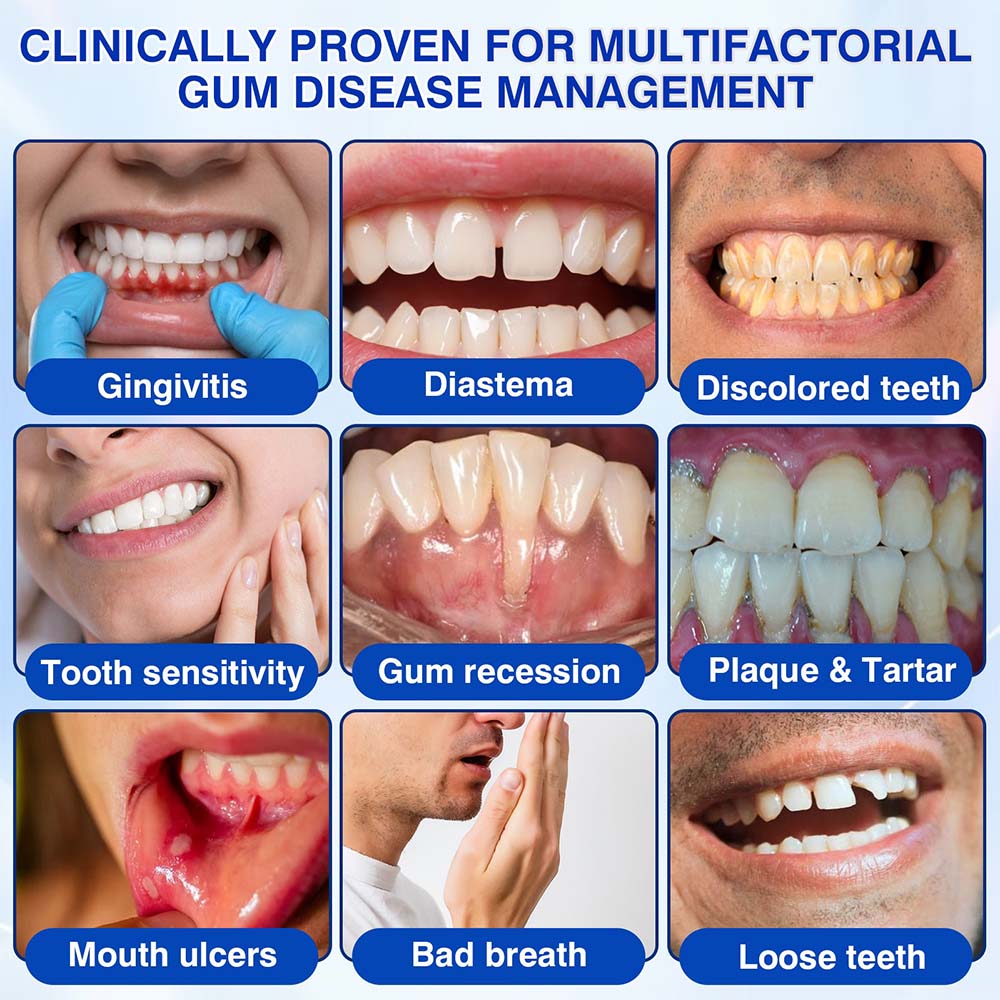 🦷𝐏𝐔𝐑𝐄𝐋𝐎𝐑𝐀® GumRevive Periodontal Repair Gel (for bleeding gums, receding gums, and loose teeth)