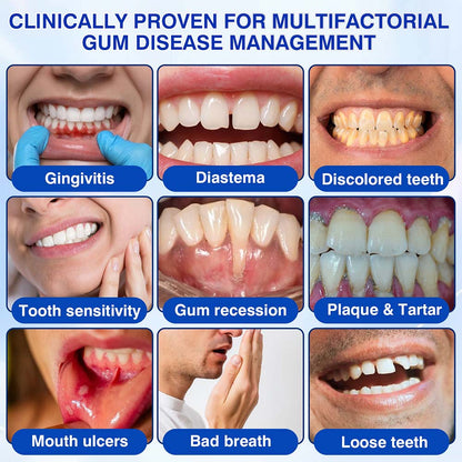 🦷𝐏𝐔𝐑𝐄𝐋𝐎𝐑𝐀® GumRevive Periodontal Repair Gel (for bleeding gums, receding gums, and loose teeth)