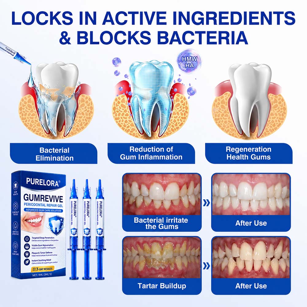 🦷𝐏𝐔𝐑𝐄𝐋𝐎𝐑𝐀® GumRevive Periodontal Repair Gel (for bleeding gums, receding gums, and loose teeth)